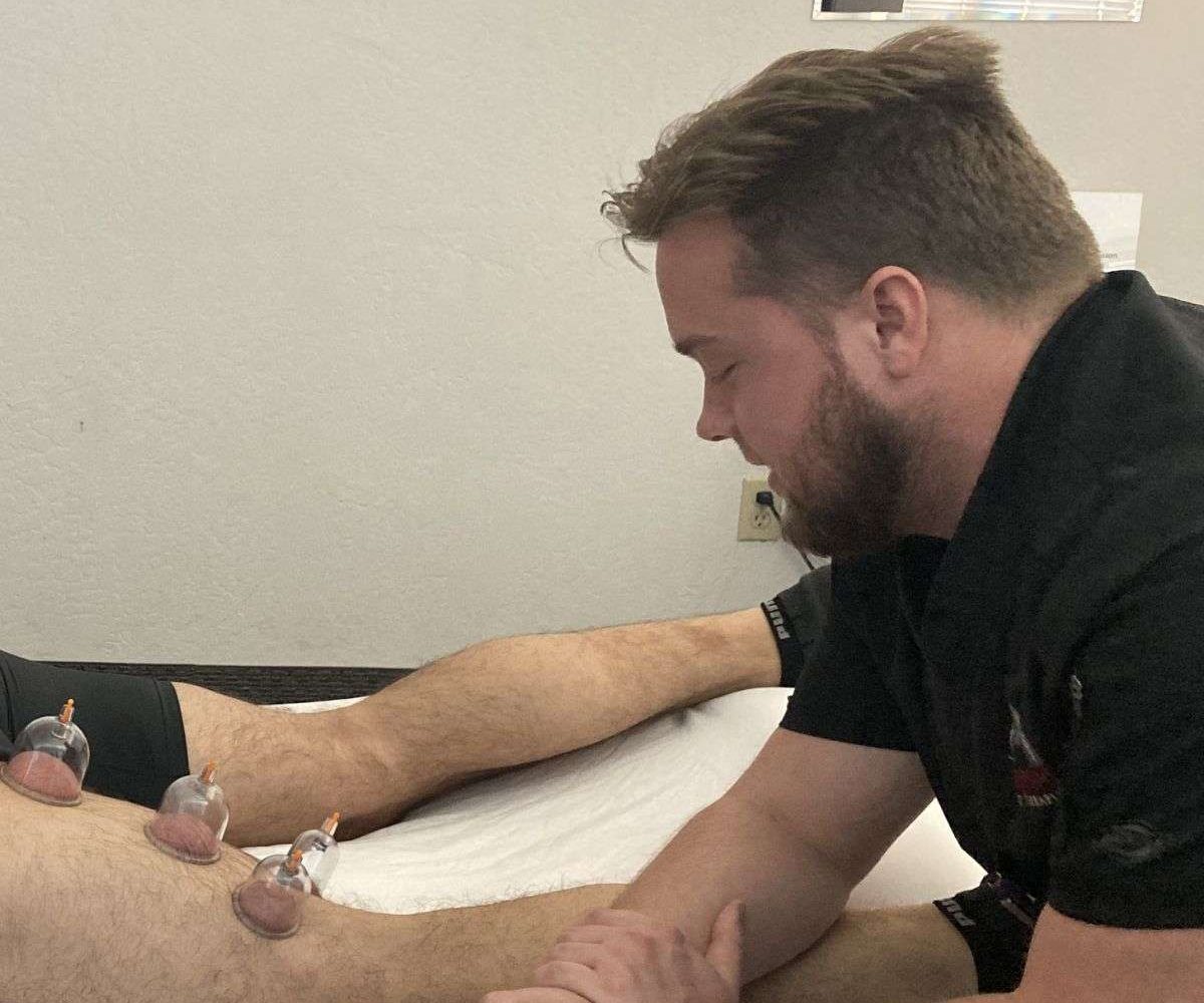 Myofascial Cupping