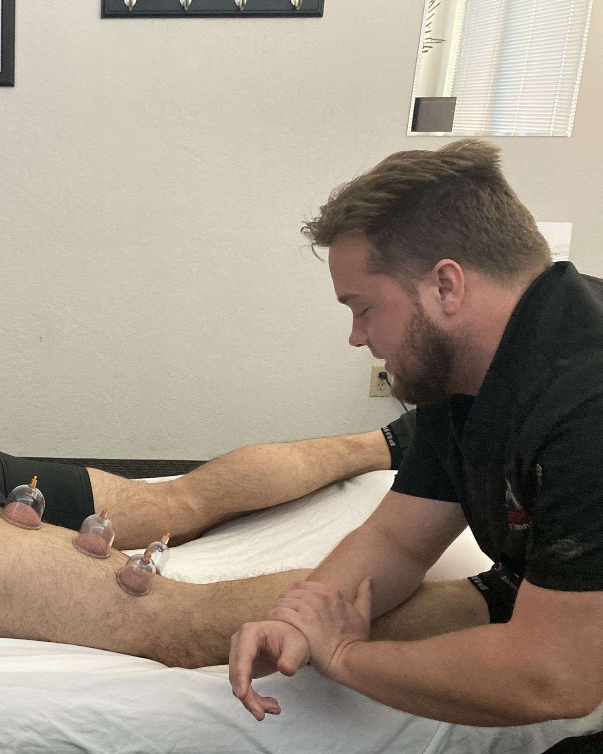 Myofascial Cupping