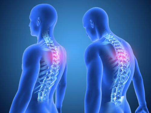 Chronic back pain